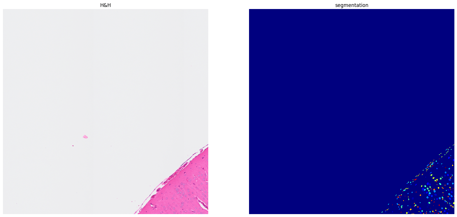 ../../_images/tutorials_notebooks_Tutorial_cell_segmentation_11_2.png