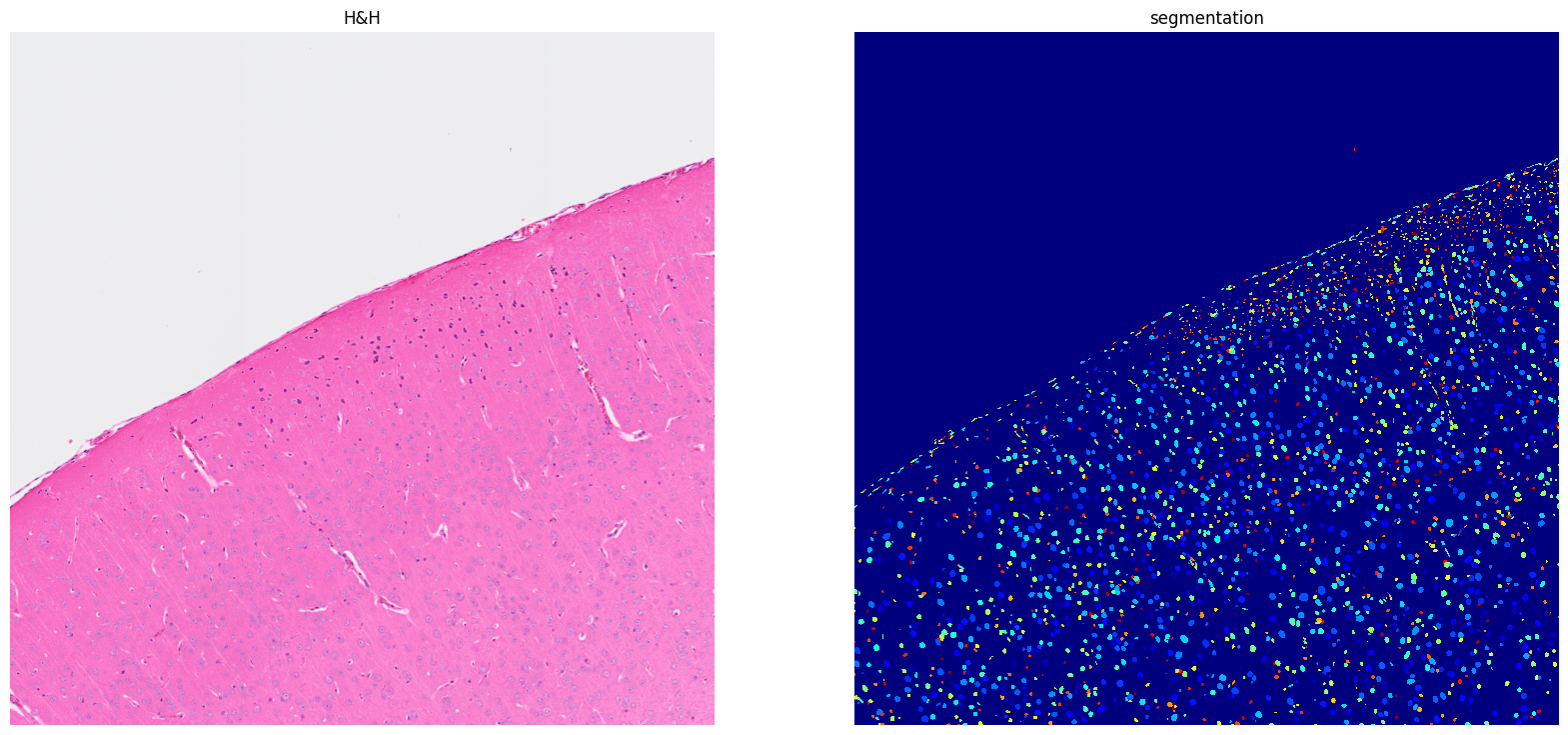 ../../_images/tutorials_notebooks_Tutorial_cell_segmentation_12_1.png