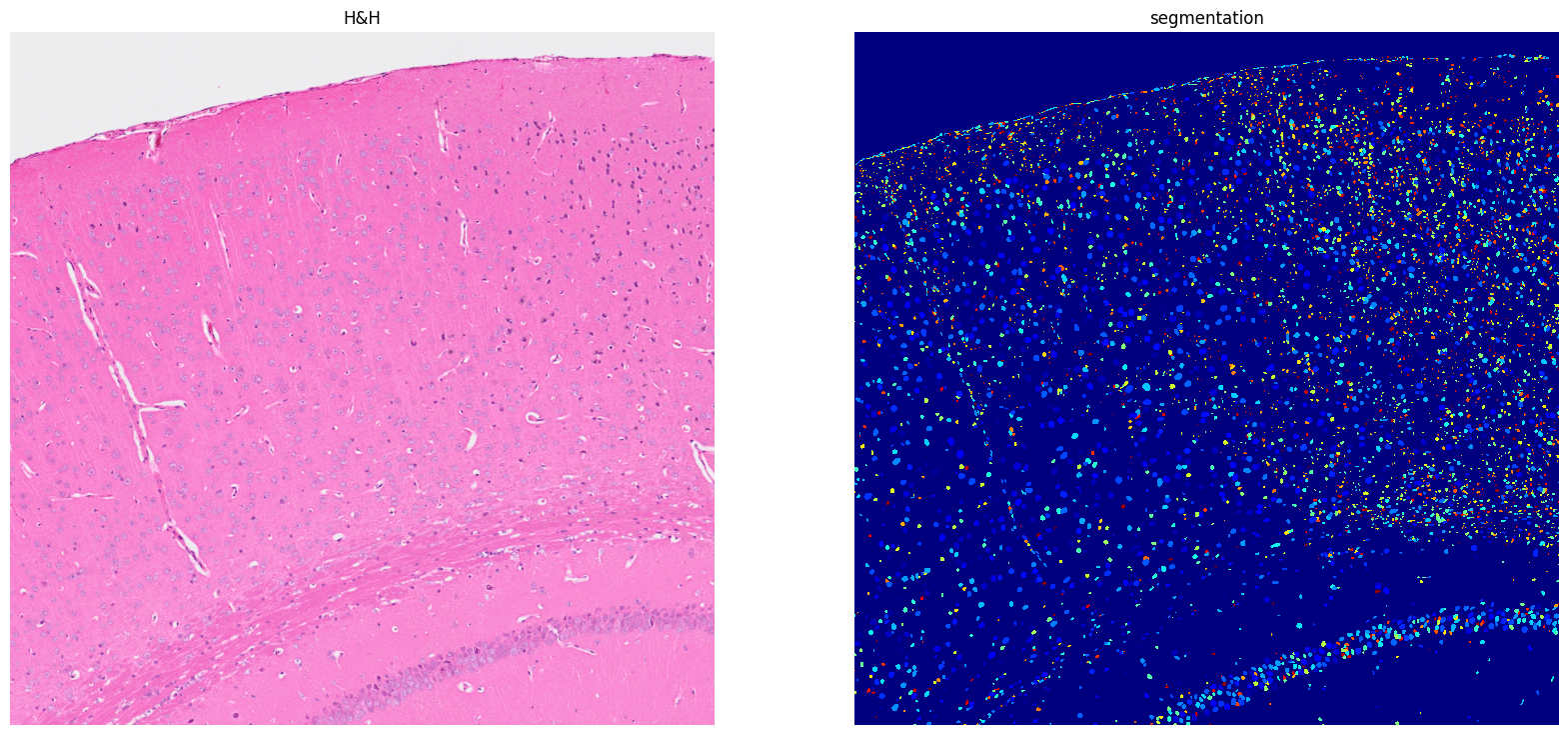 ../../_images/tutorials_notebooks_Tutorial_cell_segmentation_13_1.png