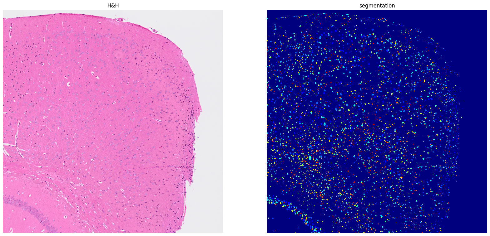../../_images/tutorials_notebooks_Tutorial_cell_segmentation_14_1.png