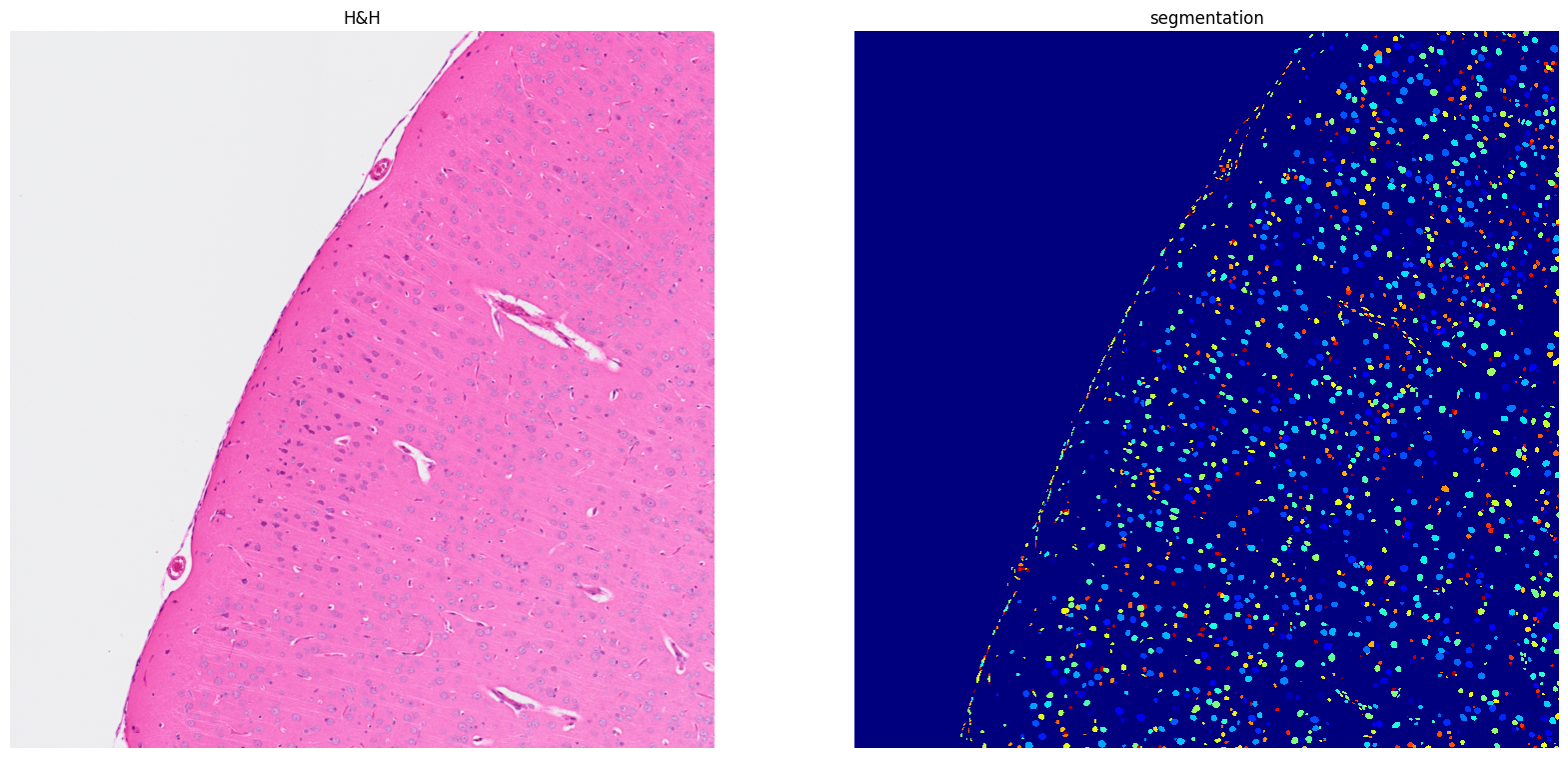 ../../_images/tutorials_notebooks_Tutorial_cell_segmentation_15_1.png