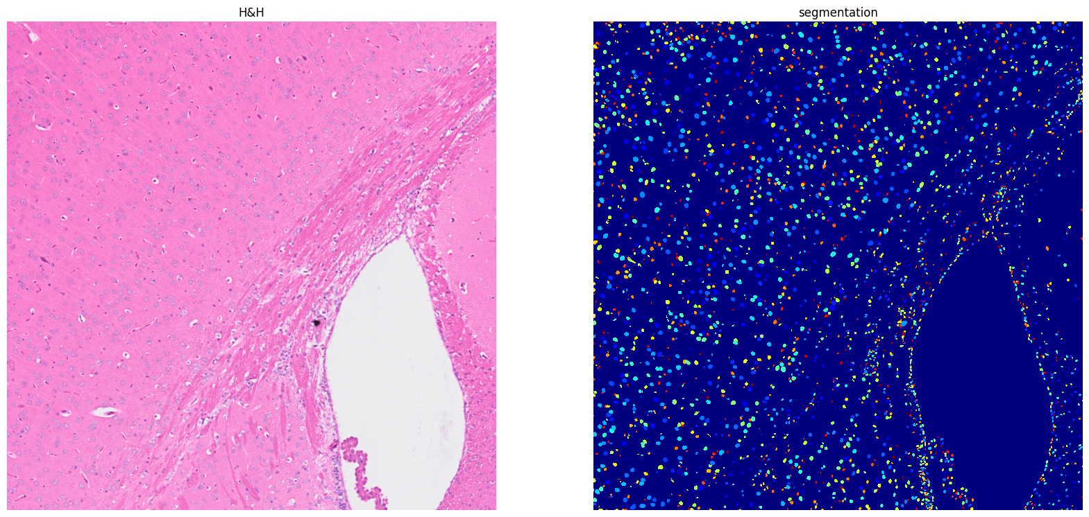 ../../_images/tutorials_notebooks_Tutorial_cell_segmentation_16_1.png