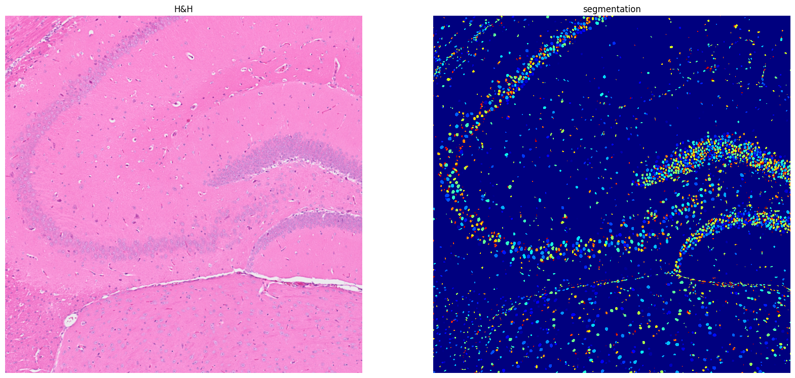 ../../_images/tutorials_notebooks_Tutorial_cell_segmentation_17_1.png