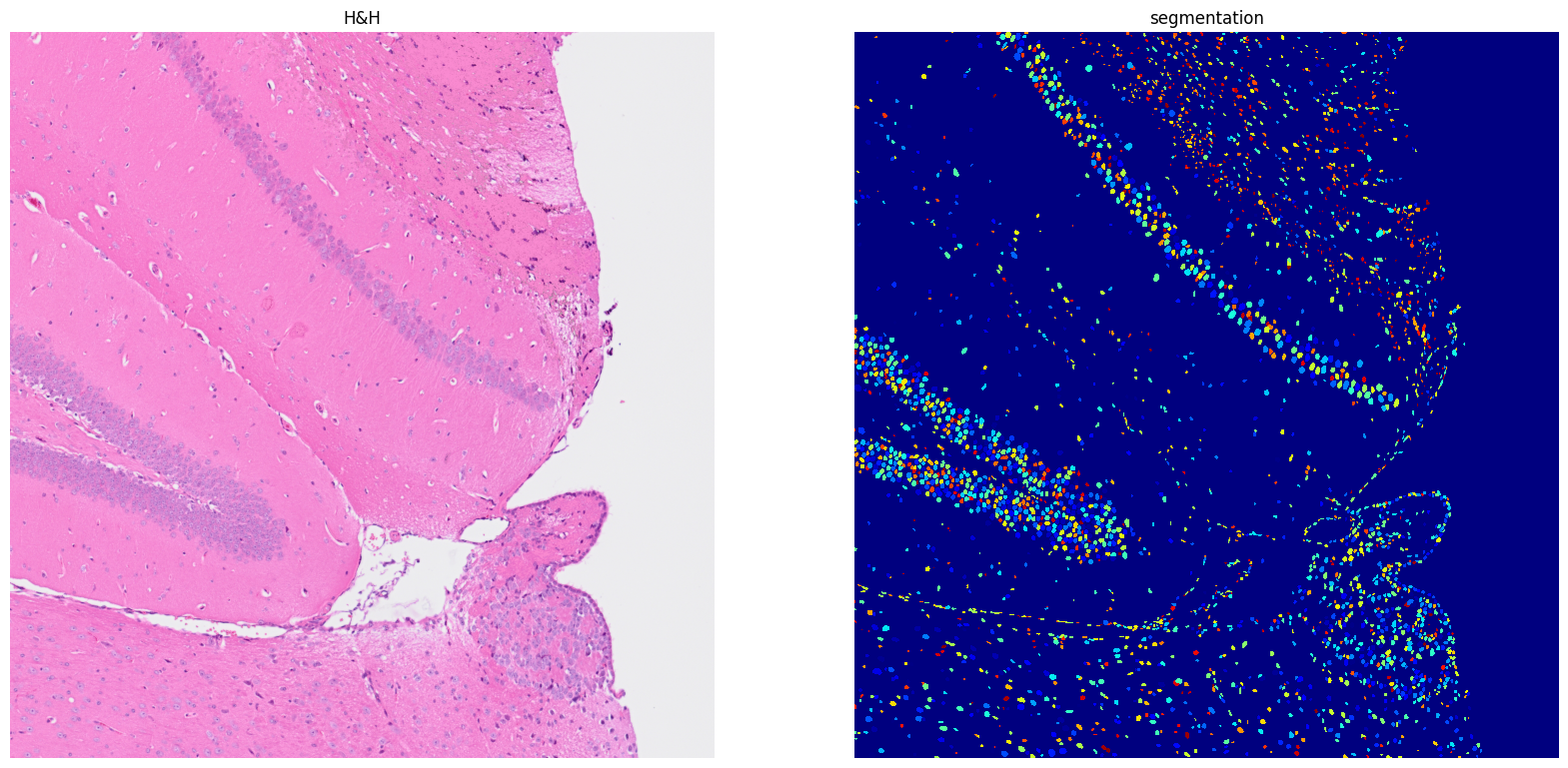 ../../_images/tutorials_notebooks_Tutorial_cell_segmentation_18_1.png