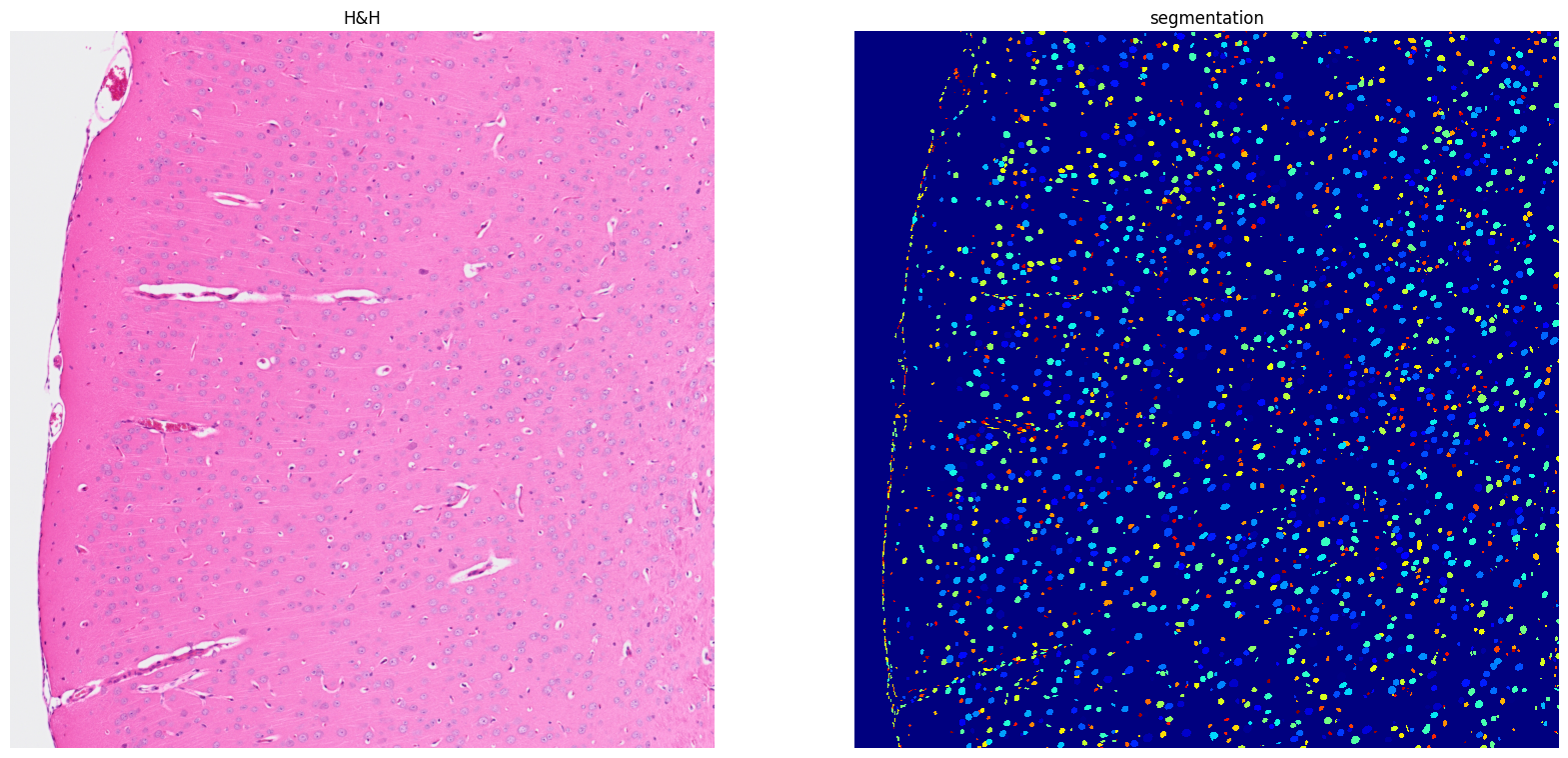 ../../_images/tutorials_notebooks_Tutorial_cell_segmentation_19_1.png