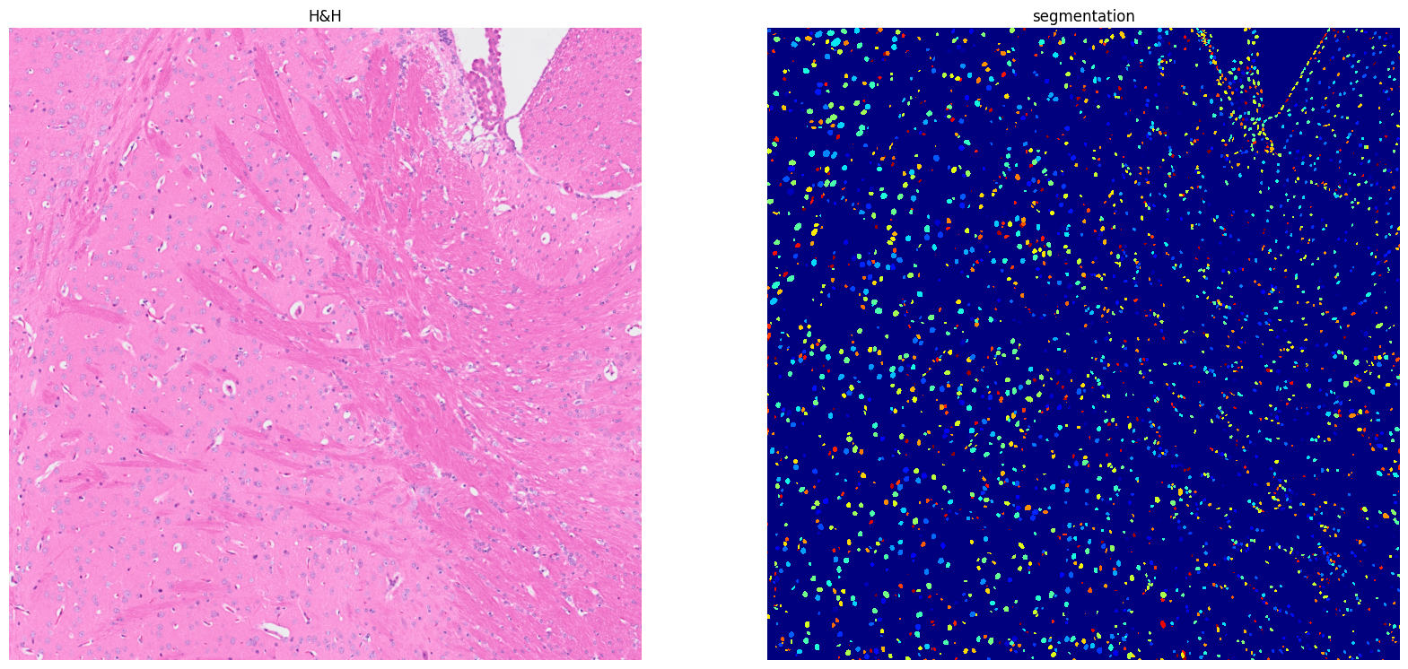 ../../_images/tutorials_notebooks_Tutorial_cell_segmentation_20_1.png