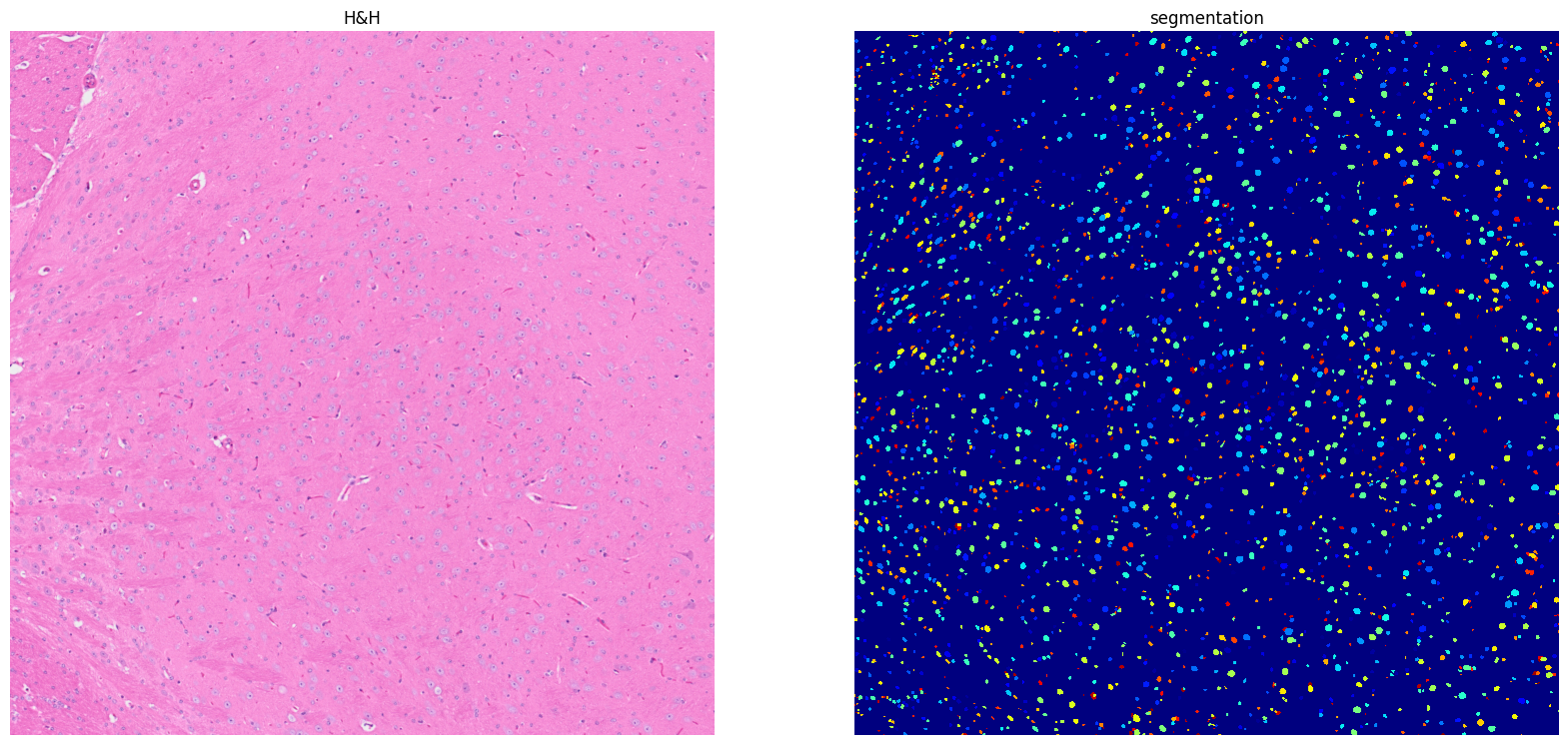 ../../_images/tutorials_notebooks_Tutorial_cell_segmentation_21_1.png