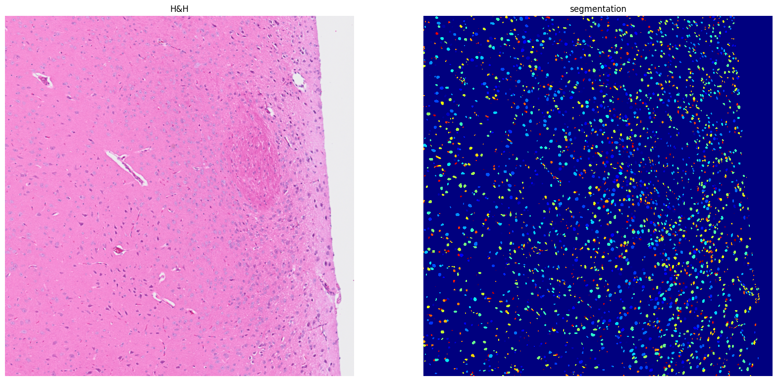 ../../_images/tutorials_notebooks_Tutorial_cell_segmentation_22_1.png