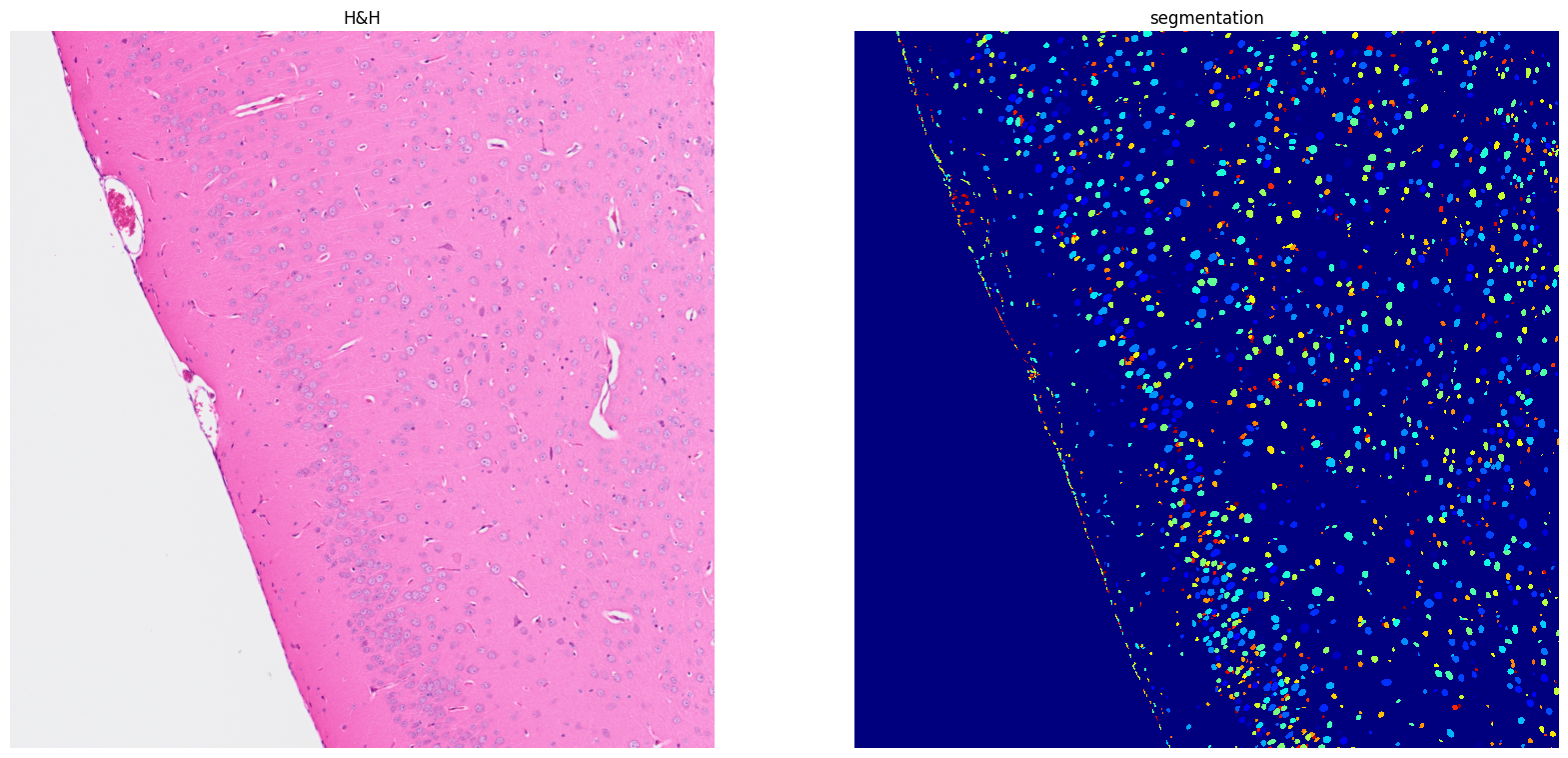 ../../_images/tutorials_notebooks_Tutorial_cell_segmentation_23_1.png