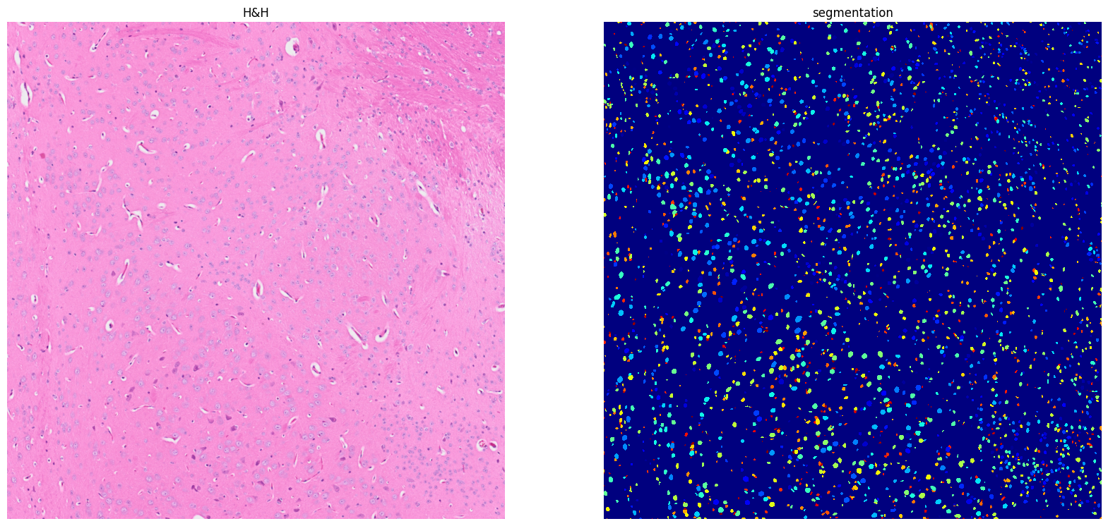 ../../_images/tutorials_notebooks_Tutorial_cell_segmentation_24_1.png