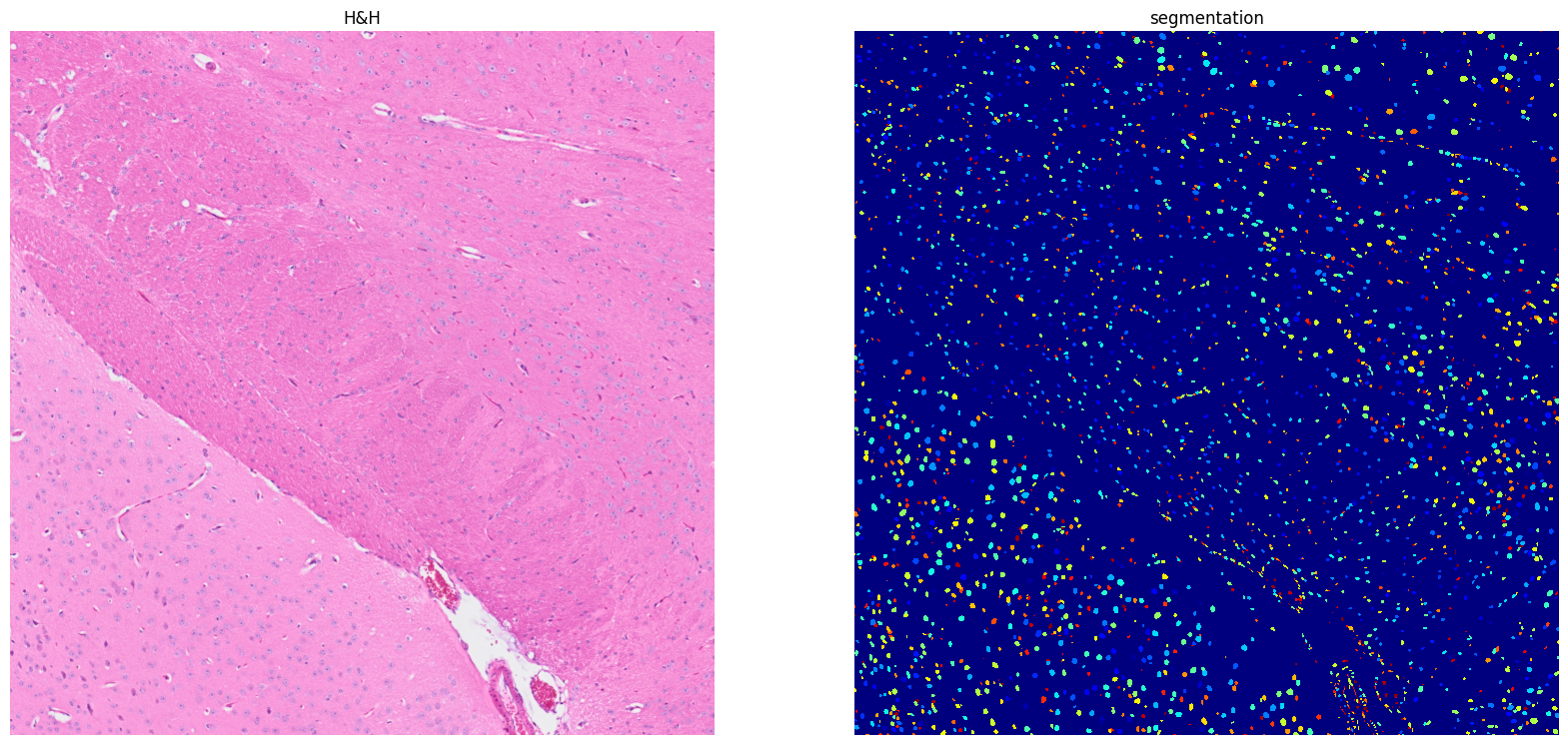 ../../_images/tutorials_notebooks_Tutorial_cell_segmentation_25_1.png