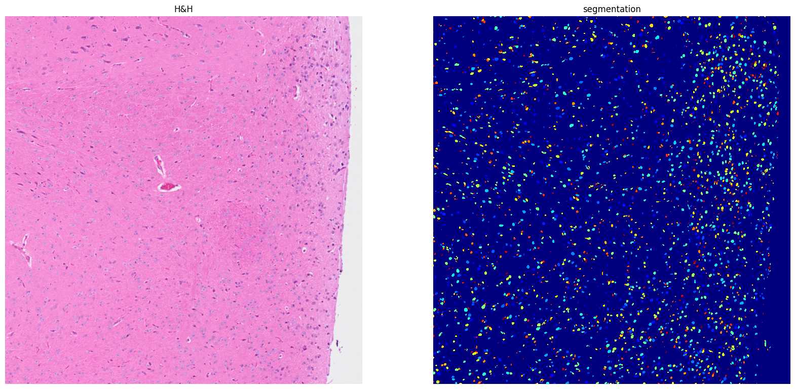 ../../_images/tutorials_notebooks_Tutorial_cell_segmentation_26_1.png