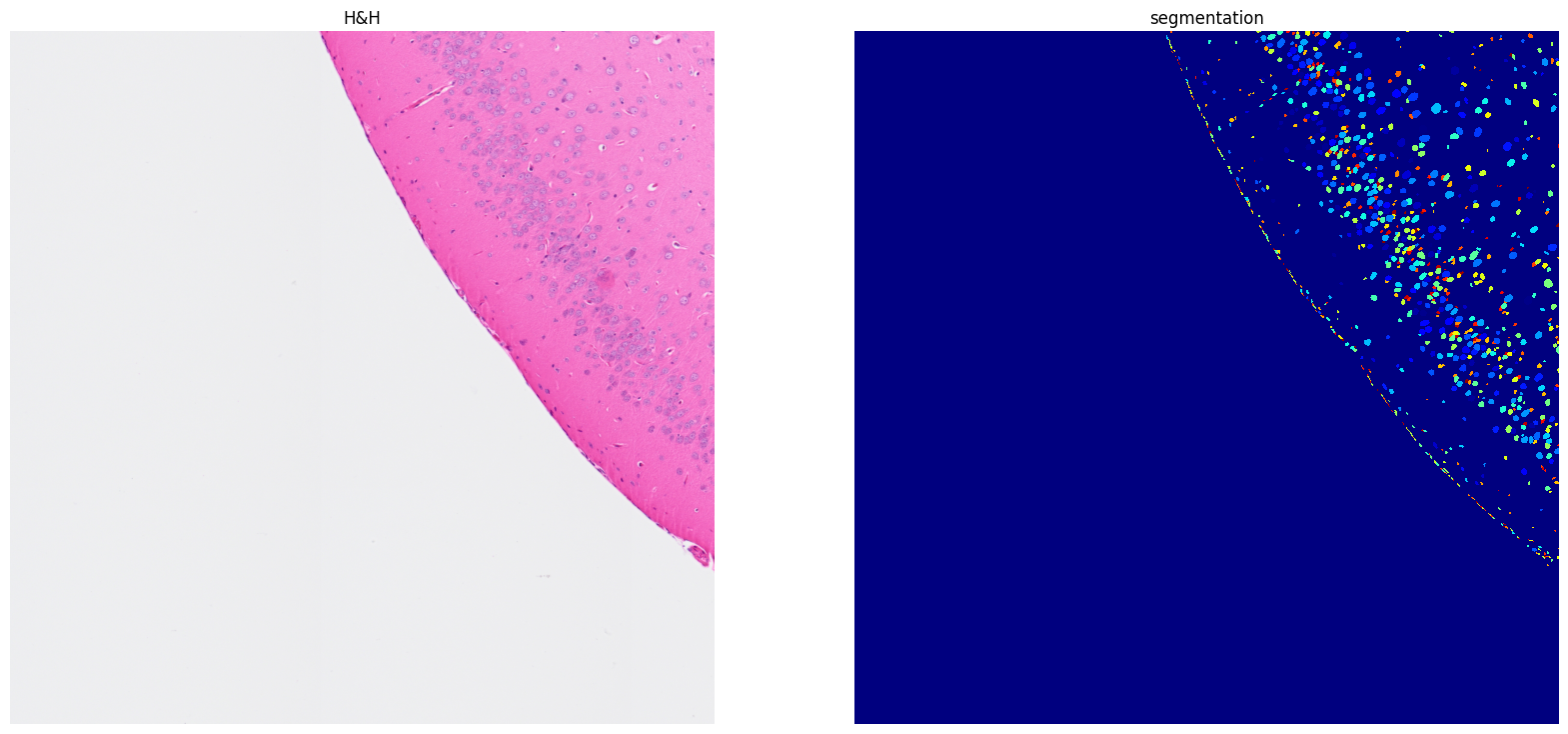 ../../_images/tutorials_notebooks_Tutorial_cell_segmentation_27_1.png