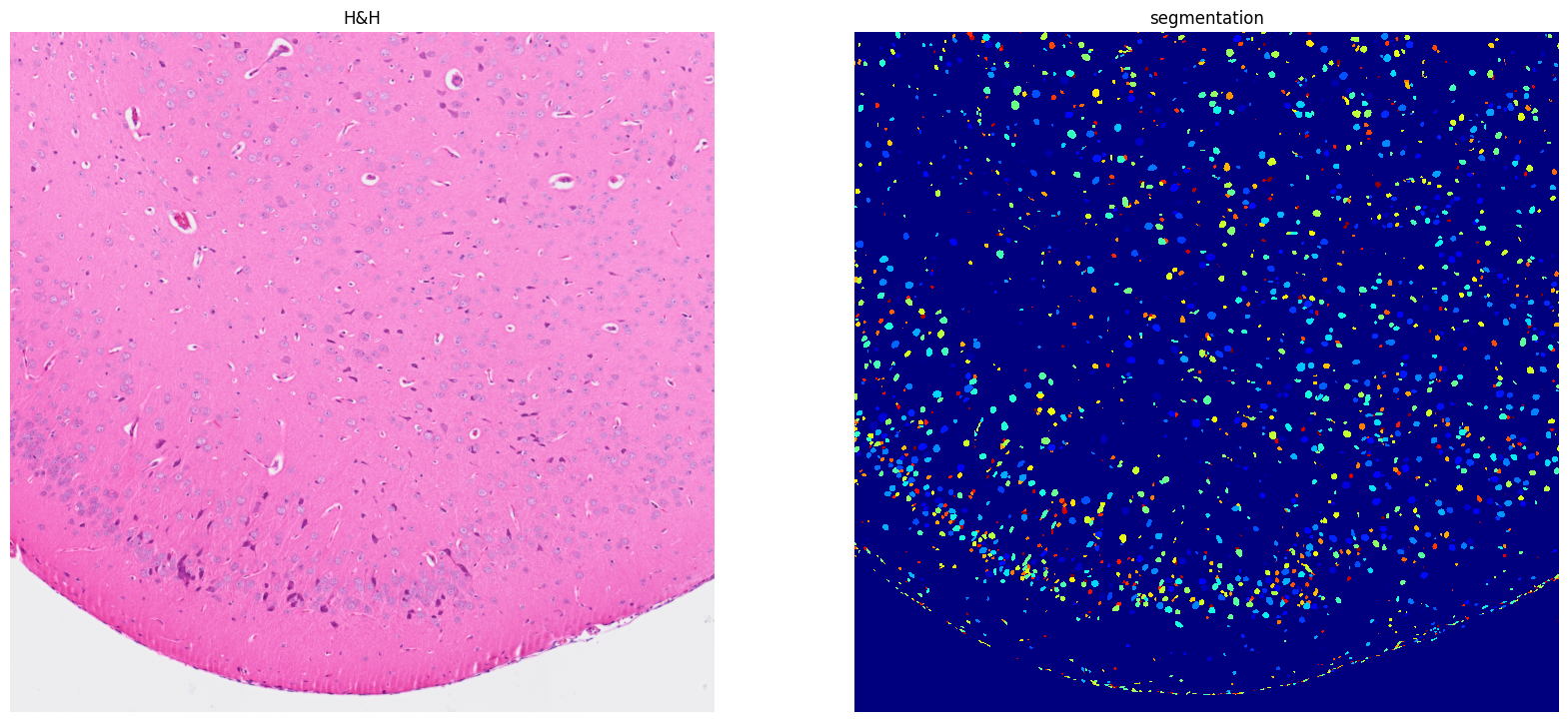 ../../_images/tutorials_notebooks_Tutorial_cell_segmentation_28_1.png