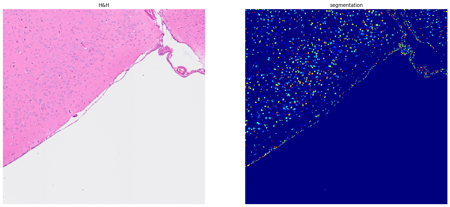 ../../_images/tutorials_notebooks_Tutorial_cell_segmentation_29_1.png
