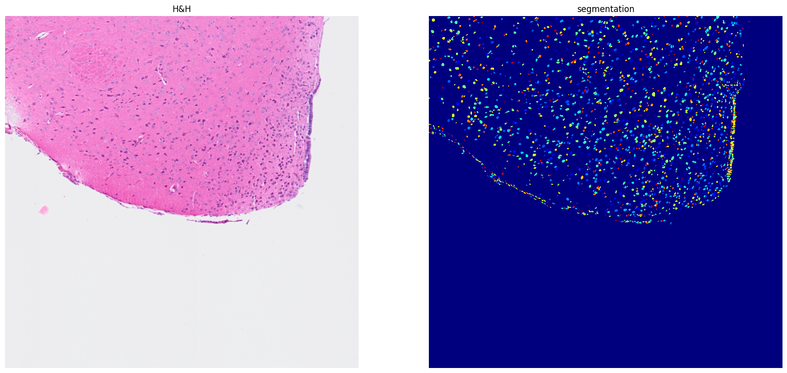 ../../_images/tutorials_notebooks_Tutorial_cell_segmentation_30_1.png